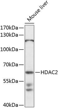 HDAC2 Rabbit Polyclonal Antibody (CAB13618)