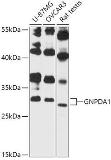 GNPDA1 Rabbit Polyclonal Antibody (CAB13717)