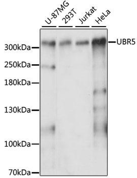 UBR5 Rabbit Polyclonal Antibody (CAB13816)