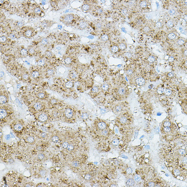 EIF2AK1 Rabbit Polyclonal Antibody (CAB14119)