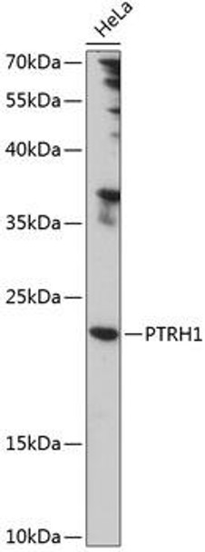 PTRH1 Rabbit Polyclonal Antibody (CAB14448)
