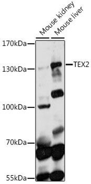 TEX2 Rabbit Polyclonal Antibody (CAB14686)