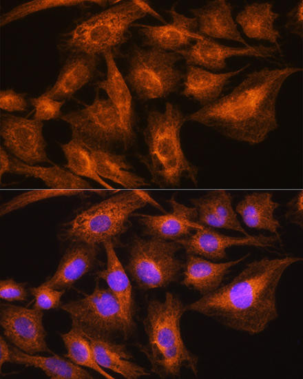 APOA2 Rabbit Polyclonal Antibody (CAB14690)