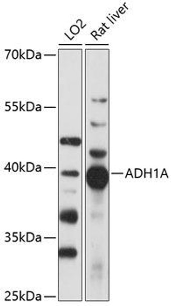 Alcohol Dehydrogenase Rabbit Polyclonal Antibody (CAB14701)