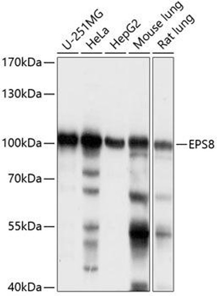 EPS8 Rabbit Polyclonal Antibody (CAB14730)