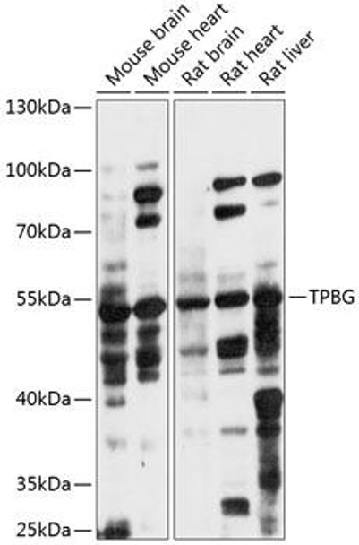 5T4 Rabbit Polyclonal Antibody (CAB14790)