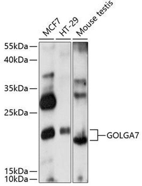 GOLGA7 Rabbit Polyclonal Antibody (CAB14888)