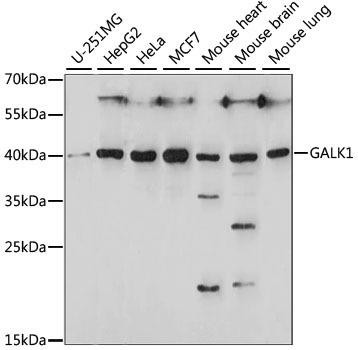 GALK1 Rabbit Polyclonal Antibody (CAB15274)