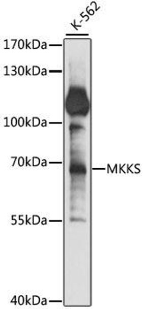 MKKS Rabbit Polyclonal Antibody (CAB15336)