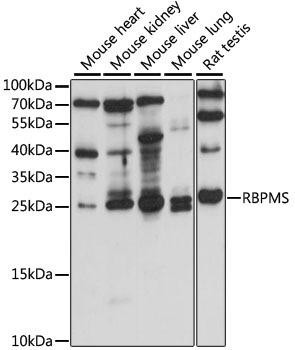 RBPMS Rabbit Polyclonal Antibody (CAB15395)