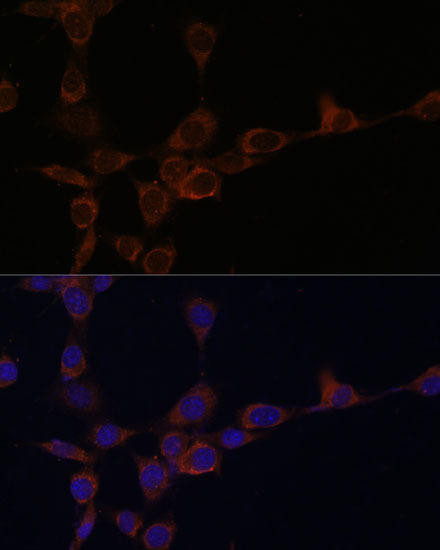 PIK3R4/VPS15 Rabbit Polyclonal Antibody (CAB15828)