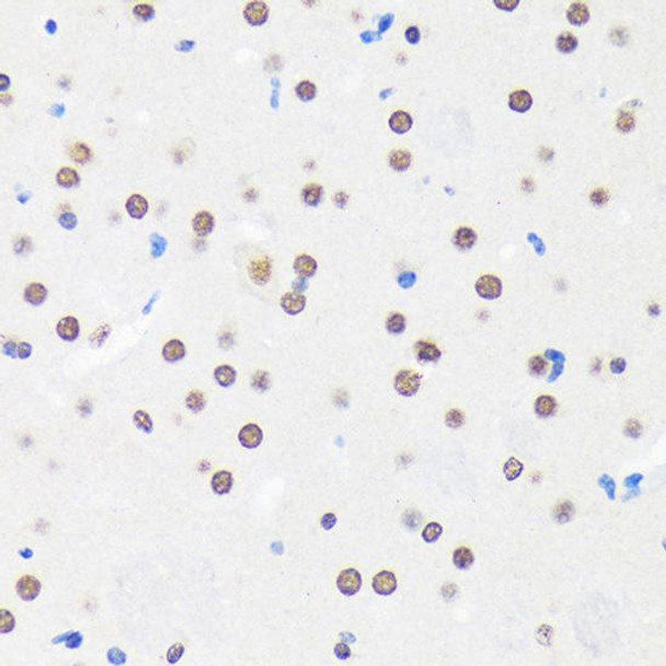 MYEF2 Rabbit Polyclonal Antibody (CAB15829)