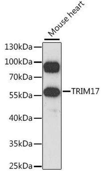 TRIM17 Rabbit Polyclonal Antibody (CAB15836)