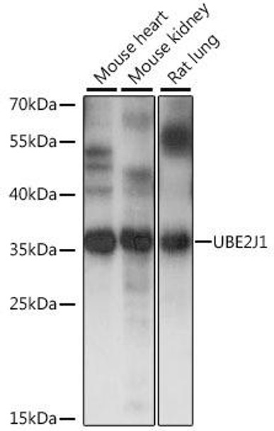 UBE2J1 Rabbit Polyclonal Antibody (CAB15841)