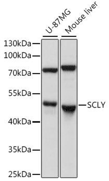 SCLY Rabbit Polyclonal Antibody (CAB15842)
