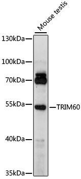 TRIM60 Rabbit Polyclonal Antibody (CAB15963)