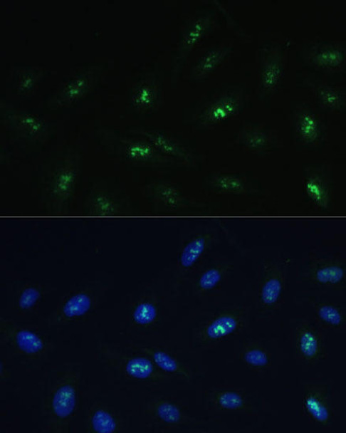 HNF4G Rabbit Polyclonal Antibody (CAB16051)