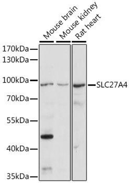 SLC27A4 Rabbit Polyclonal Antibody (CAB16101)