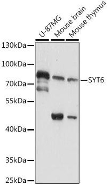 SYT6 Rabbit Polyclonal Antibody (CAB16171)