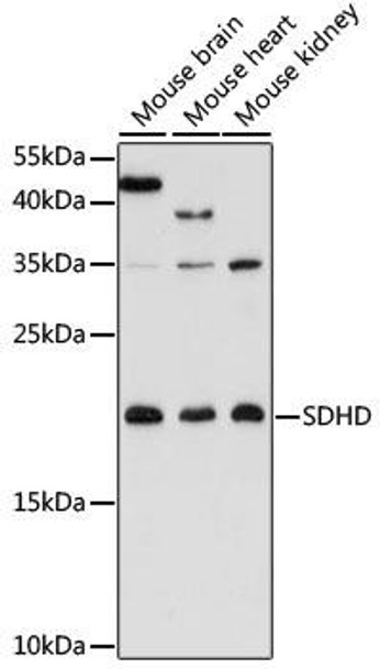 SDHD Rabbit Polyclonal Antibody (CAB16240)
