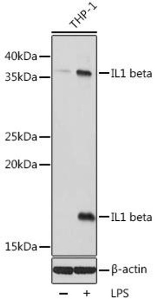IL1β Rabbit Polyclonal Antibody (CAB16288)