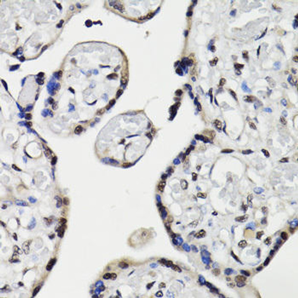 NAV2 Rabbit Polyclonal Antibody (CAB16300)