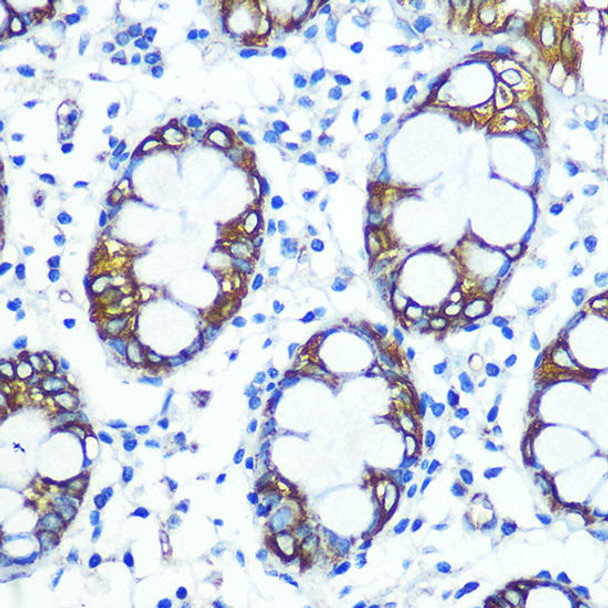 FUT4 Rabbit Polyclonal Antibody (CAB16320)