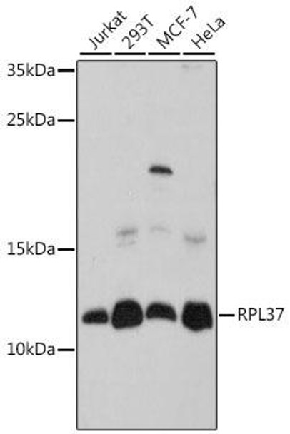 RPL37 Rabbit Polyclonal Antibody (CAB16335)