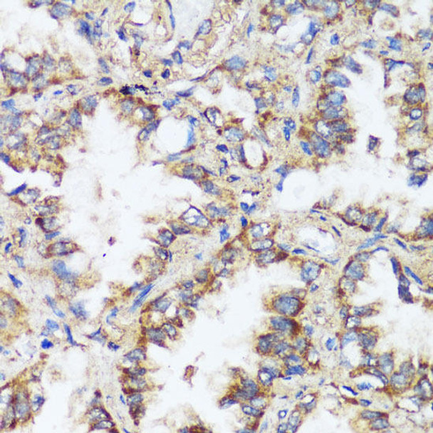 ERK1/ERK2 Rabbit Polyclonal Antibody (CAB16686)