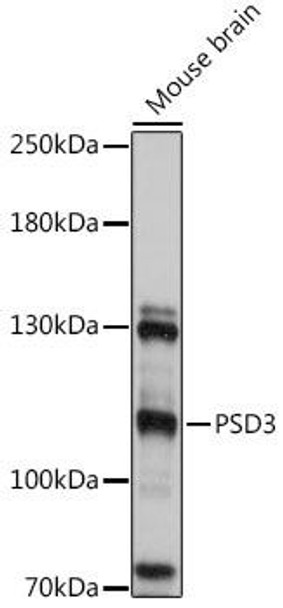 PSD3 Rabbit Polyclonal Antibody (CAB16888)