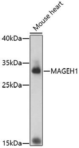 MAGEH1 Rabbit Polyclonal Antibody (CAB17143)