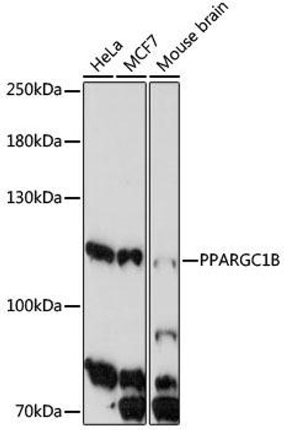 PGC1 beta Rabbit Polyclonal Antibody (CAB17257)