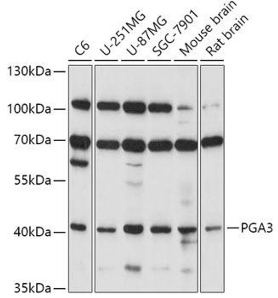 PGA3 Rabbit Polyclonal Antibody (CAB17321)