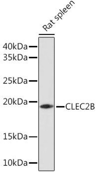 CLEC2B Rabbit Polyclonal Antibody (CAB17338)