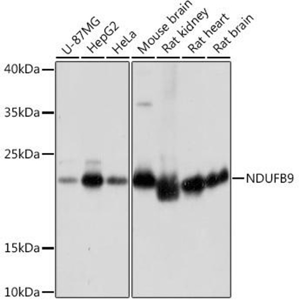 NDUFB9 Rabbit Polyclonal Antibody (CAB17454)