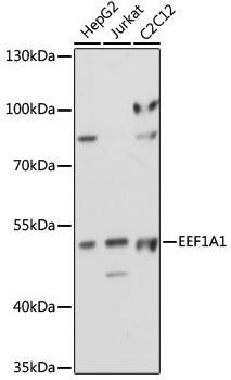eEF1A1 Rabbit Polyclonal Antibody (CAB17857)