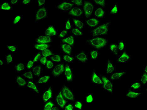 HSD3B2 Rabbit Polyclonal Antibody (CAB1823)