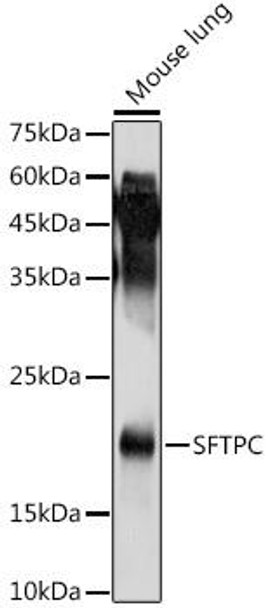 SFTPC Rabbit Polyclonal Antibody (CAB1835)