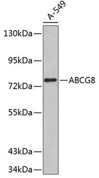 ABCG8 Rabbit Polyclonal Antibody (CAB1880)