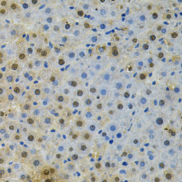 BUB1 Rabbit Polyclonal Antibody (CAB1929)