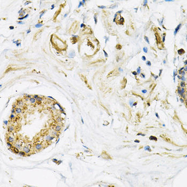 LAMP2 Rabbit Polyclonal Antibody (CAB1961)