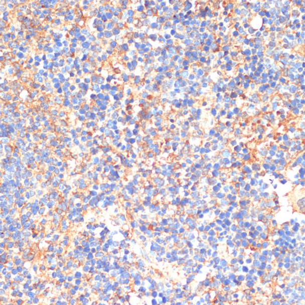 SIGLEC3/CD33 Rabbit Polyclonal Antibody (CAB2059)