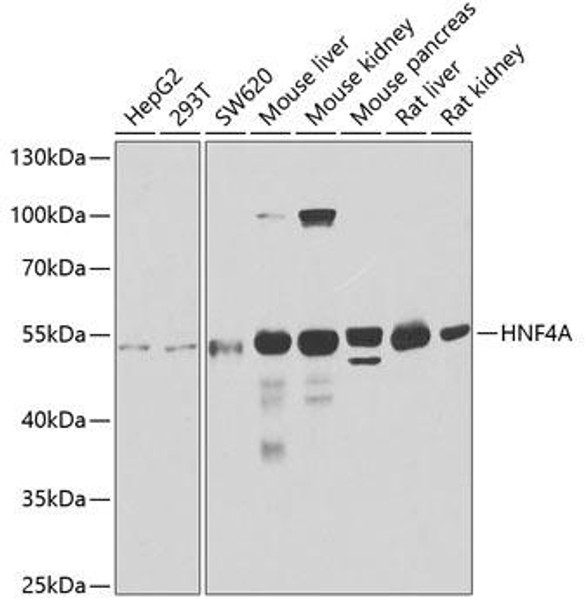 HNF4A Rabbit Polyclonal Antibody (CAB2085)