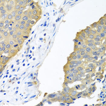eIF4E Rabbit Polyclonal Antibody (CAB2162)