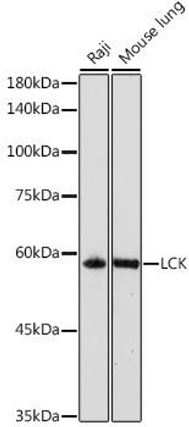 LCK Rabbit Polyclonal Antibody (CAB2177)