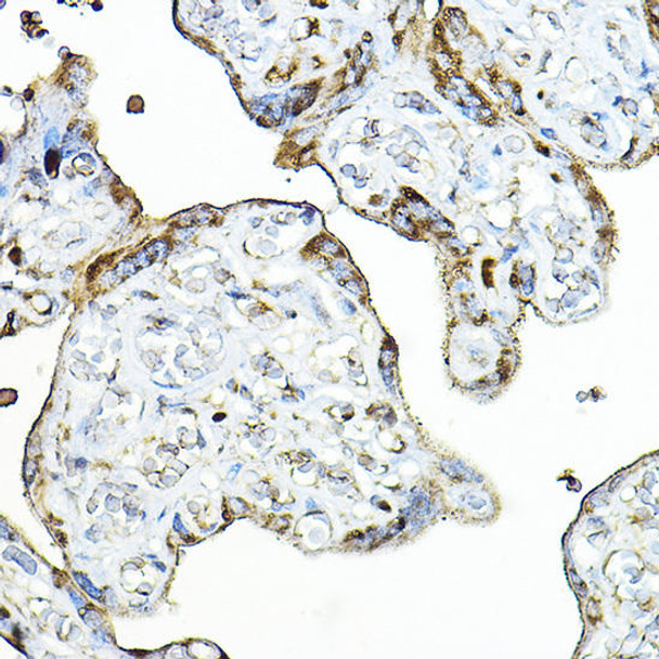 PRG2 Rabbit Polyclonal Antibody (CAB2532)