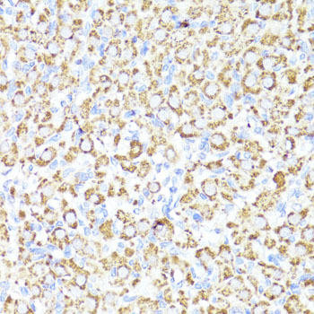 CYP3A4 Rabbit Polyclonal Antibody (CAB2544)