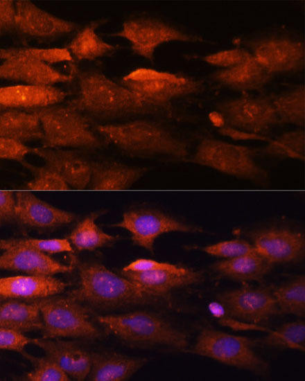 Cell Cycle Antibodies 1 Anti-N-WASP Antibody CAB2576