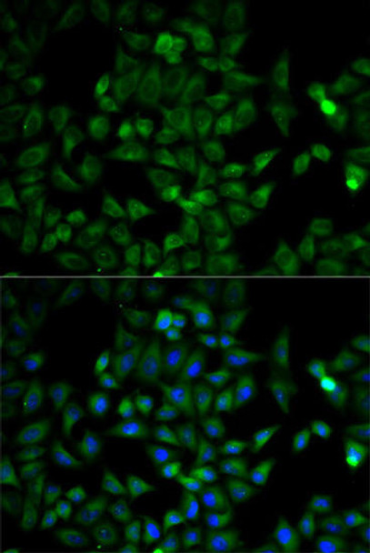 TPI1 Rabbit Polyclonal Antibody (CAB2579)