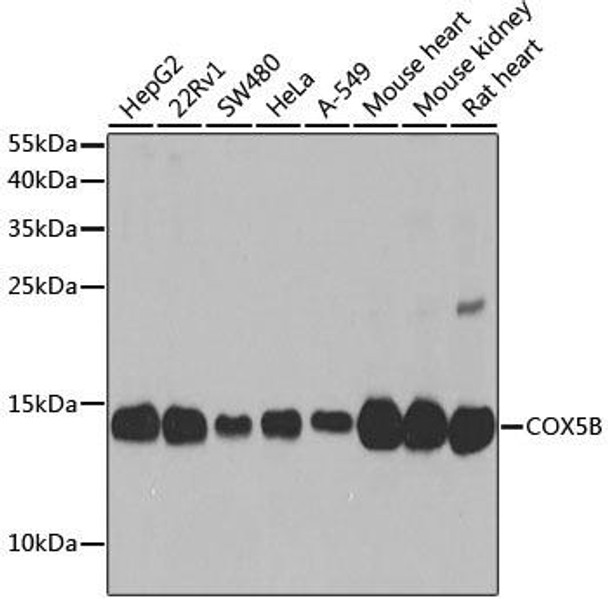 COX5B Rabbit Polyclonal Antibody (CAB2640)